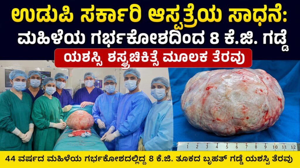 udupi woman surgery success: ಉಡುಪಿ ಸರ್ಕಾರಿ ಆಸ್ಪತ್ರೆಯ ಸಾಧನೆ: ಮಹಿಳೆಯ ಗರ್ಭಕೋಶದಿಂದ 8 ಕೆ.ಜಿ. ಗಡ್ಡೆ ಯಶಸ್ವಿ ಶಸ್ತ್ರಚಿಕಿತ್ಸೆ ಮೂಲಕ ತೆರವು